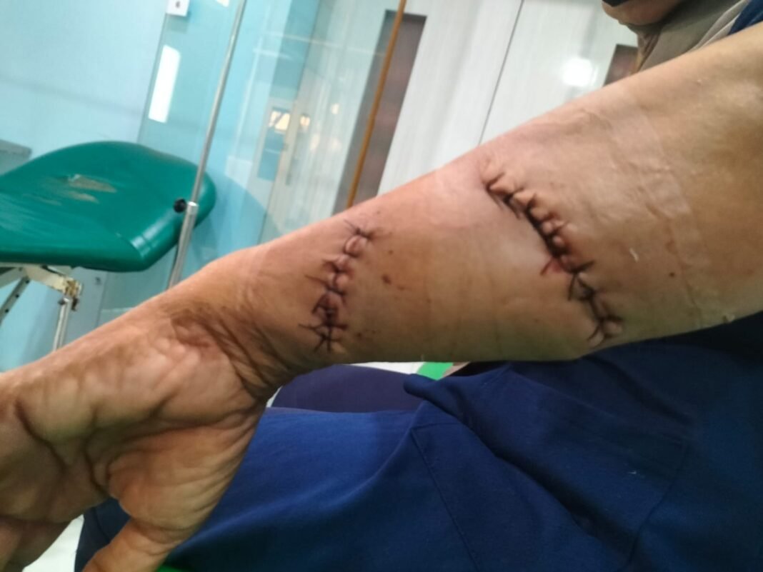 Diduga Dipicu Sengketa Lahan Sawah, Seorang Ibu di Rawadalem Alami Luka Serius Akibat Penganiayaan Diduga Dipicu Sengketa Lahan Sawah, Seorang Ibu di Rawadalem Alami Luka Serius Akibat Penganiayaan